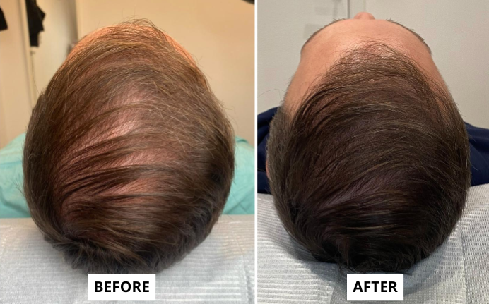 hair-1-e1749652858382