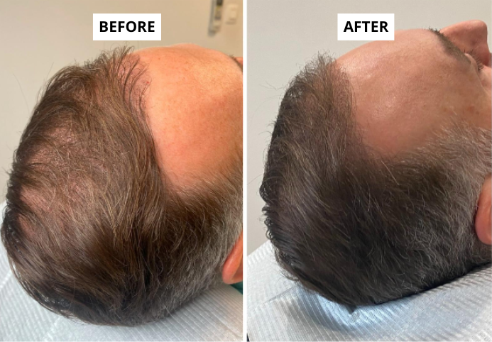 hair-2-e1749652924501