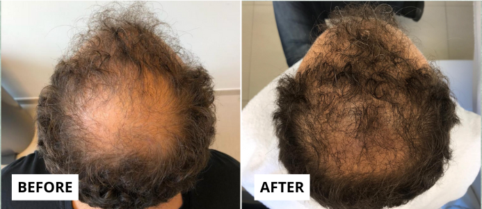 hair-3-e1749653031827