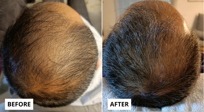 hair-4-e1749653816349