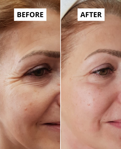 lifting-10-1-e1749649328719