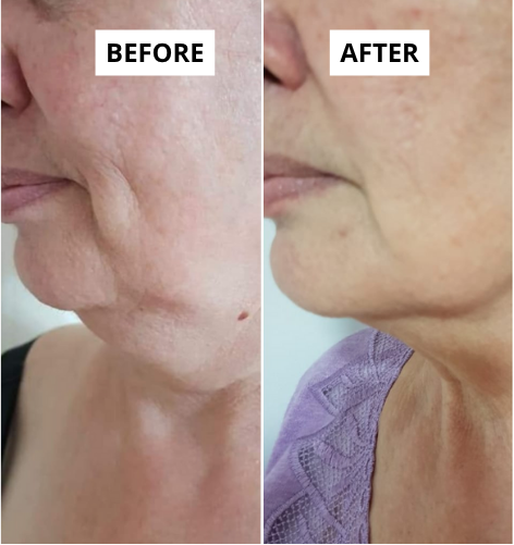 lifting-11-1-e1749649454633