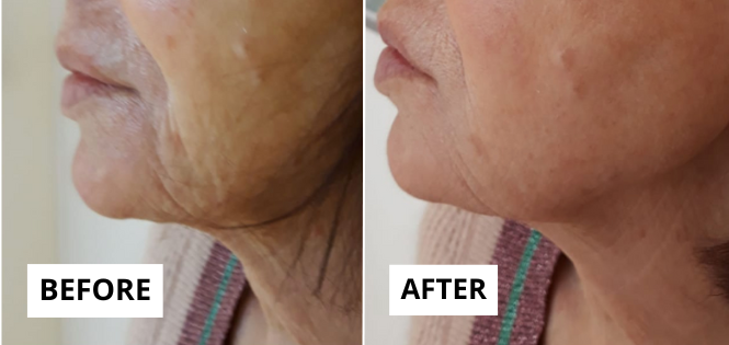 lifting-12-e1749649615660