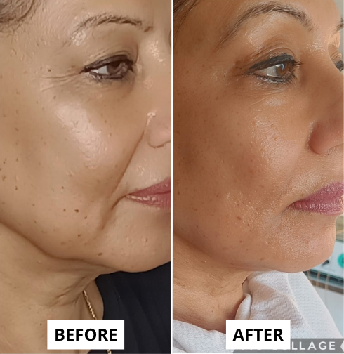 lifting-20-e1749669699241