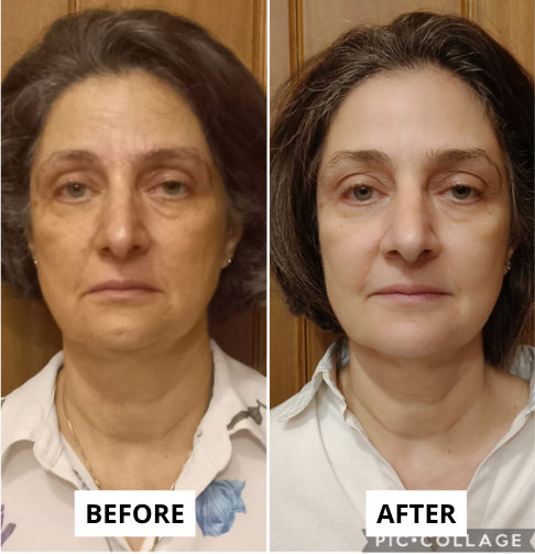 lifting-22-e1749670353838