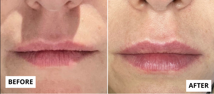 lifting-23-e1749670478387