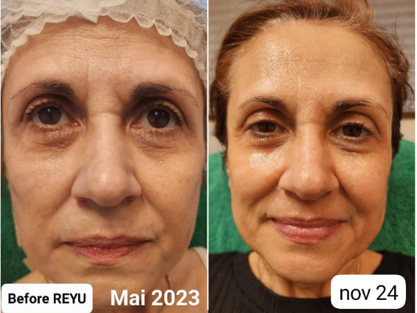 lifting-24-e1749670591516