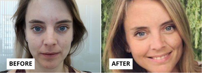 skin-1-1-2-e1749725383210