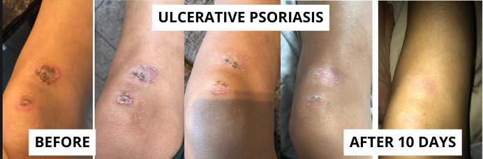 skin-1-3-e1749725636117