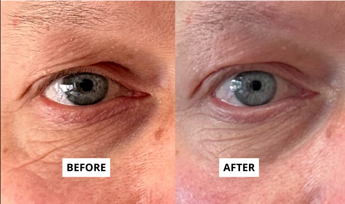 skin-1-4-e1749726029510