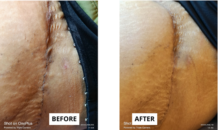 skin-1-5-e1749726052348