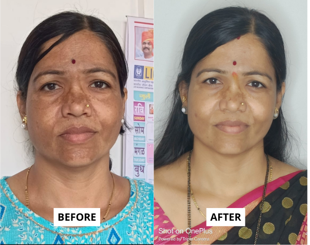 skin-1-6-e1749726085793