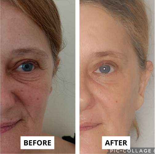 skin-1-e1749725734346