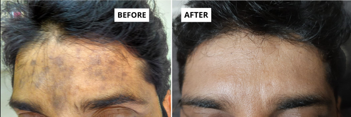 skin-2-1-e1749650955417