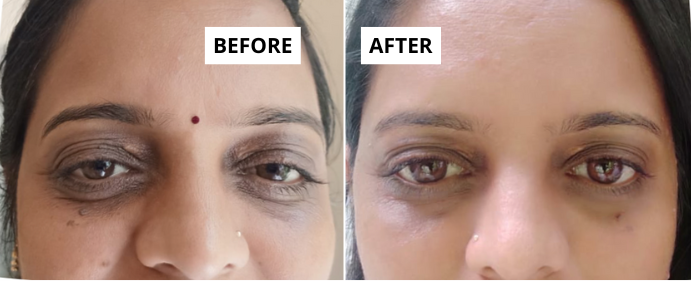 skin-3-1-e1749651158813