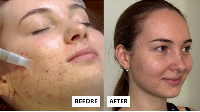 skin-6-1-e1749651431704